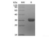 Recombinant Human Angiopoietin-2/ANG2 (C-6His)