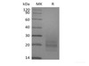 Recombinant Human CD3D&CD3E Heterodimer (C-6His)
