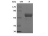 Recombinant Human TSLP R/CRLF2 (C-Fc)