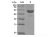 Recombinant Human Carbonic Anhydrase IX/CA9 (C-6His)