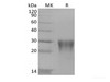 Recombinant Human Transforming Growth Factor Beta-1/TGFB1