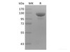 Human Receptor Tyrosine-Recombinant Protein Kinase ErbB-3/HER3 (C-mFc)