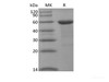Recombinant Human BRD4 (N-10His-Flag)