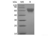 Recombinant Human B7-2/CD86 (C-Avi-6His) Biotinylated