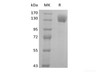 Recombinant Human P-selectin/CD62P (C-Fc)
