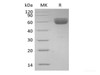 Recombinant Human Basigin/CD147 (C-Fc)