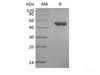 Recombinant Human ILDR2 (C-6His)