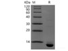 Recombinant Human CLDN18.2(N-6His,C-Avi)