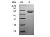 Recombinant Mouse Alpha-1-antitrypsin 1-1/Serpin A1e (C-6His)