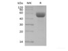 Recombinant Mouse CD79B/B29 (C-Fc)