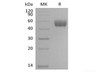 Mouse NKG2-D type II Integral Membrane Recombinant Protein/NKG2D/CD314 (N-Fc)