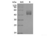 Recombinant Mouse ALK-5/TGFBR1 (C-Fc)