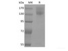 Recombinant Mouse Leptin Receptor/LEPR/CD295 (C-mFc)