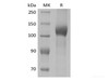 Recombinant Mouse Leptin Receptor/LEPR/CD295 (C-10His)