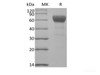 Recombinant Mouse Transforming Growth Factor-Beta Receptor Type II/TGFBR2 (C-Fc)
