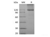 Recombinant Mouse TGFBR3 (C-6His)