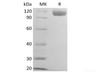 Recombinant Mouse B-cell Receptor CD22/Siglec-2/CD22 (C-6His)