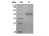 Recombinant Mouse TNF Receptor II/TNF RII/TNFRSF1B/CD120b  (C-6His-Avi) Biotinylated