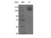 Recombinant Mouse Leptin Receptor/LEPR/CD295 (C-Fc)