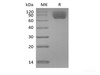 Recombinant Mouse TrkC/Ntrk3 (C-6His)