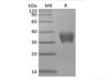 Recombinant Mouse BTNL4 (C-6His)