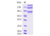 HCoV-OC43 S1+S2 Recombinant Protein (ECD, His Tag)