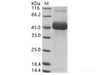 DENV (type 2, strain New Guinea C) NS1 Recombinant Protein (His Tag)