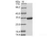 DENV-2 (strain New Guinea C) NS5 (methyltransferase domain) / Nonstructural Recombinant Protein 5 Recombinant Protein (His Tag)