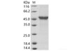 EBOV (subtype Bundibugyo, strain Uganda 2007) GP-RBD / GlycoRecombinant Protein Recombinant Protein (Fc Tag)