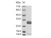 Enterovirus D68 (EV-D68) (strain Fermon) VP4 Recombinant Protein (Fc Tag)