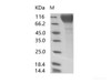 HIV-1 gp120 Recombinant Protein (group P, strain RBF168) (His Tag)