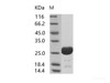 HIV-1 p24 Recombinant Protein (group O, strain BCF06) (His Tag)