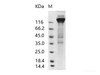 Human cytomegalovirus (HCMV) GlycoRecombinant Protein B / gB Recombinant Protein (Fc Tag)