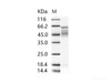 RSV Fusion Recombinant Protein / RSV-F (Strain RSS-2) Recombinant Protein (His Tag)