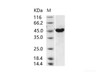 MERS-CoV NucleoRecombinant Protein / NP Recombinant Protein (His Tag)