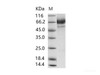MERS-CoV Spike/S2 Recombinant Protein (S2 Subunit, aa 726-1296, His Tag)