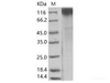 SIV (isolate F236) envelope glycoRecombinant Protein gp120 Recombinant Protein (His Tag)