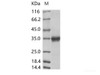 ZIKV (strain Zika SPH2016) Stem/anchor domain of flavivirus envelope glycoRecombinant Protein E Recombinant Protein (Fc Tag)