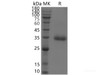 Recombinant SARS-CoV-2 Spike RBD (E484K, K417T, N501Y) (His Tag)