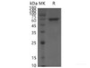 SARS-CoV-2 NSP12 Recombinant Protein