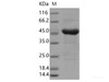 SARS-CoV-2 N Recombinant Protein (S194L) (His Tag)