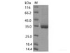 Recombinant SARS-CoV-2 Spike RBD (K417N) (His Tag)