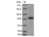 Recombinant SARS-CoV-2 Spike RBD (K417N) (His Tag), Biotinylated