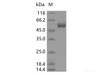 Recombinant SARS-CoV-2 Spike RBD (E484K) (rFc Tag)