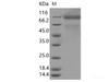 Recombinant SARS-CoV-2 Spike S1(T20N, D614G) (His Tag)