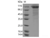 Recombinant SARS-CoV-2 Spike S1(N234Q) (His Tag)