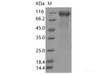 Recombinant SARS-CoV-2 Spike S1(ΔHV69-70, N439K, D614G) (His Tag)