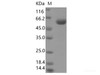 SARS-CoV-2 Spike Recombinant Protein (RBD, mFc Tag) (V367F)