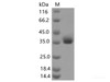 Recombinant SARS-CoV-2 Spike RBD (K444R) (His Tag)