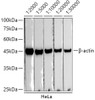 HRP-conjugated Donkey anti-Rabbit IgG (H+L) (CABS038)